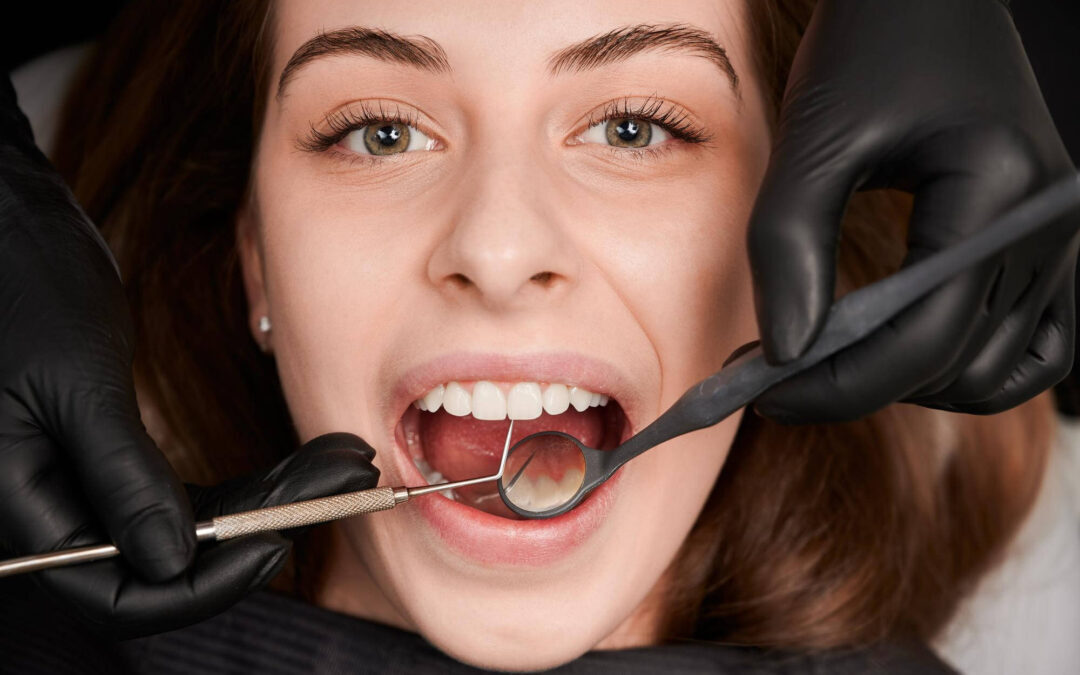 Gingivitis: Causes, Symptoms, and Treatment